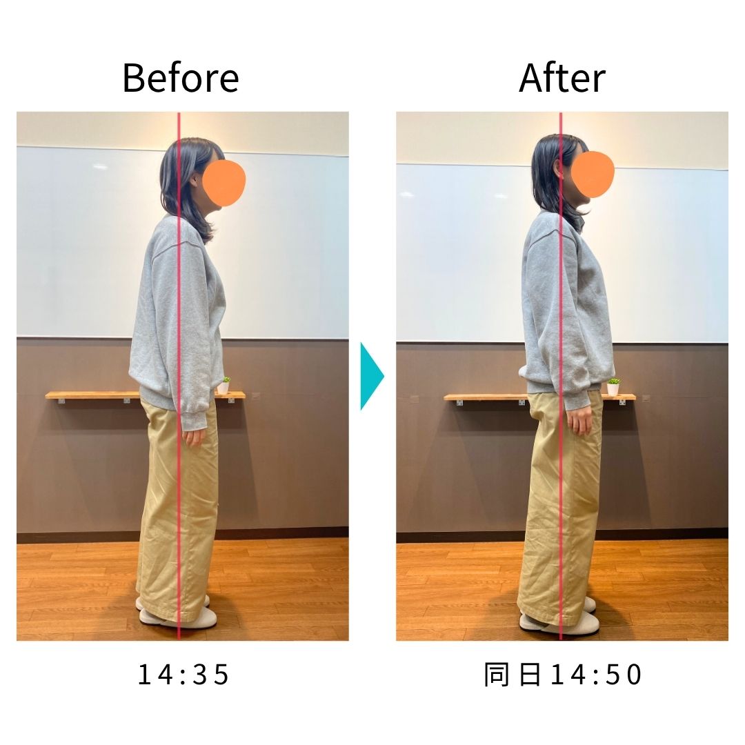 Before After 比較写真