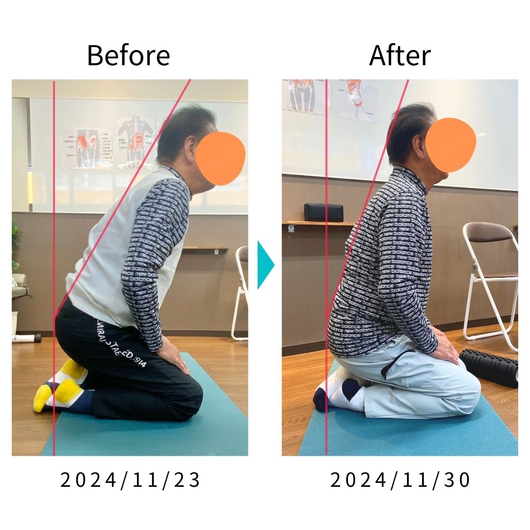 Before After 比較写真