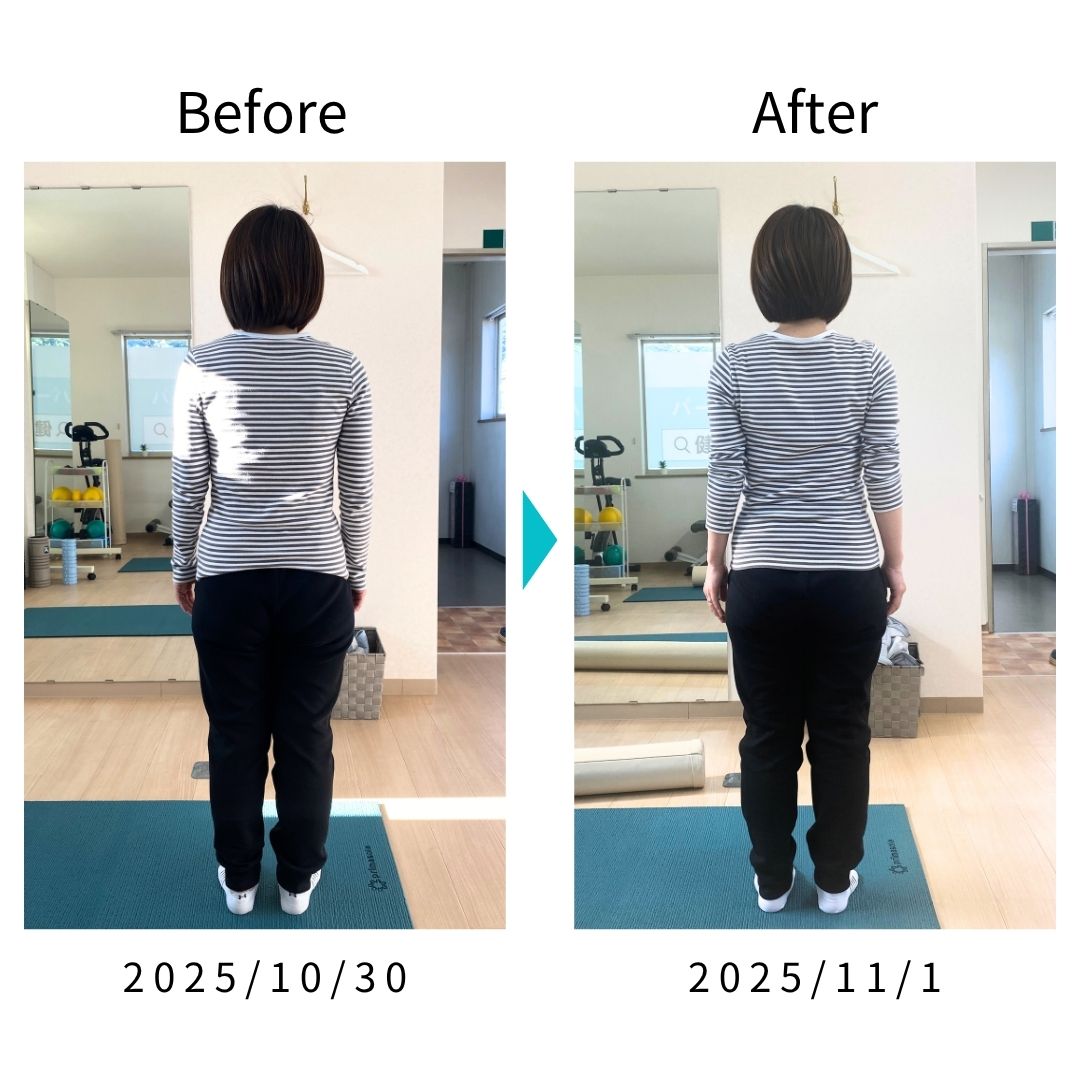 Before After 比較写真